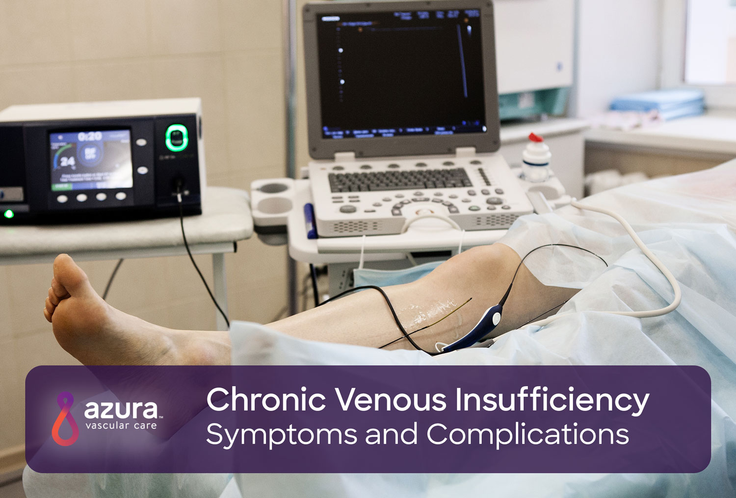 Symptoms and Complications of Chronic Venous Insufficiency