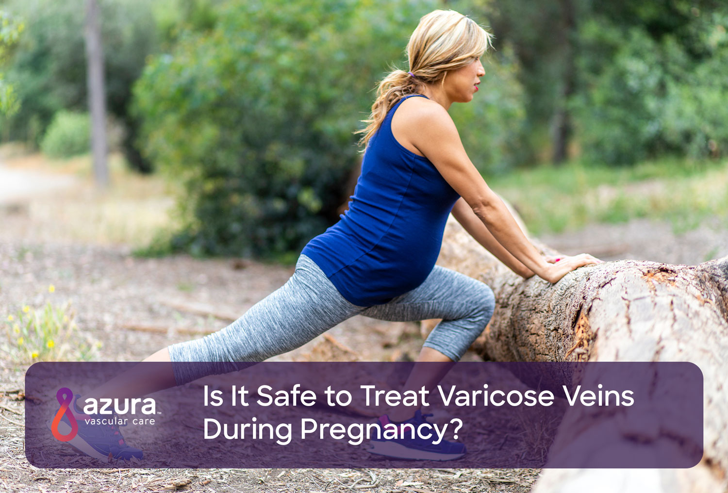Treating Varicose Veins During Pregnancy