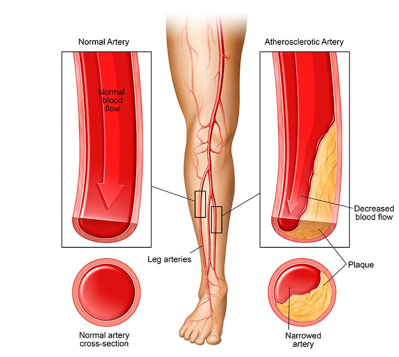 The Cardiovascular System of the Leg and Foot