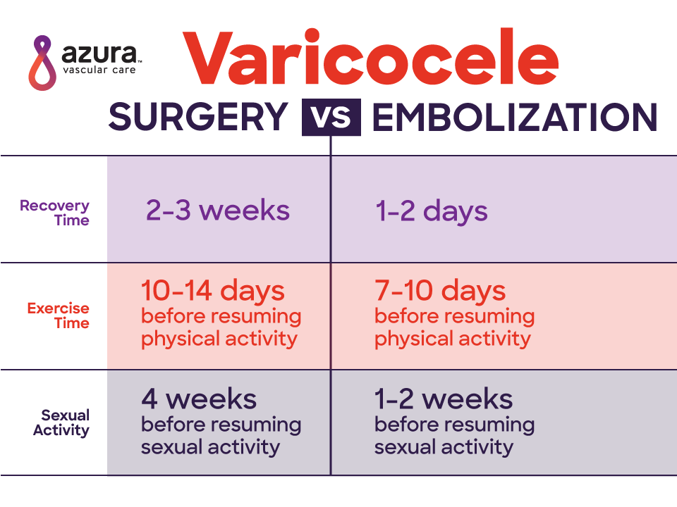 Varicocele Treatment Options  Embolization vs Varicocele Surgery