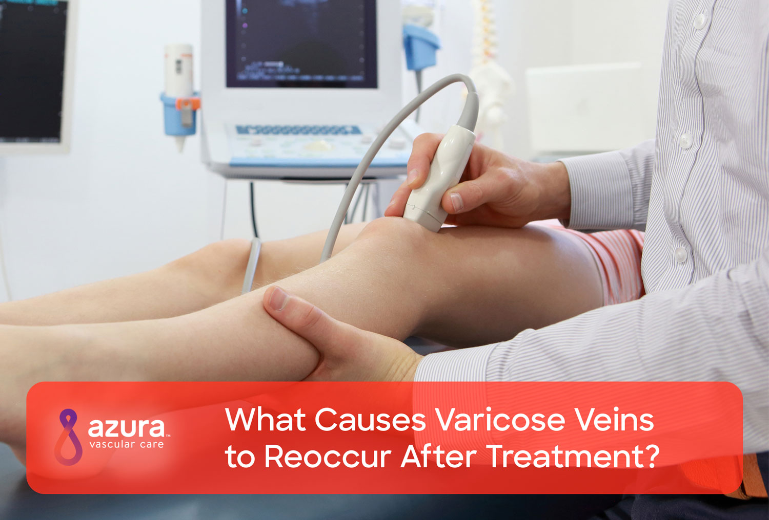 What Would Cause Varicose Veins to Reoccur After Treatment?