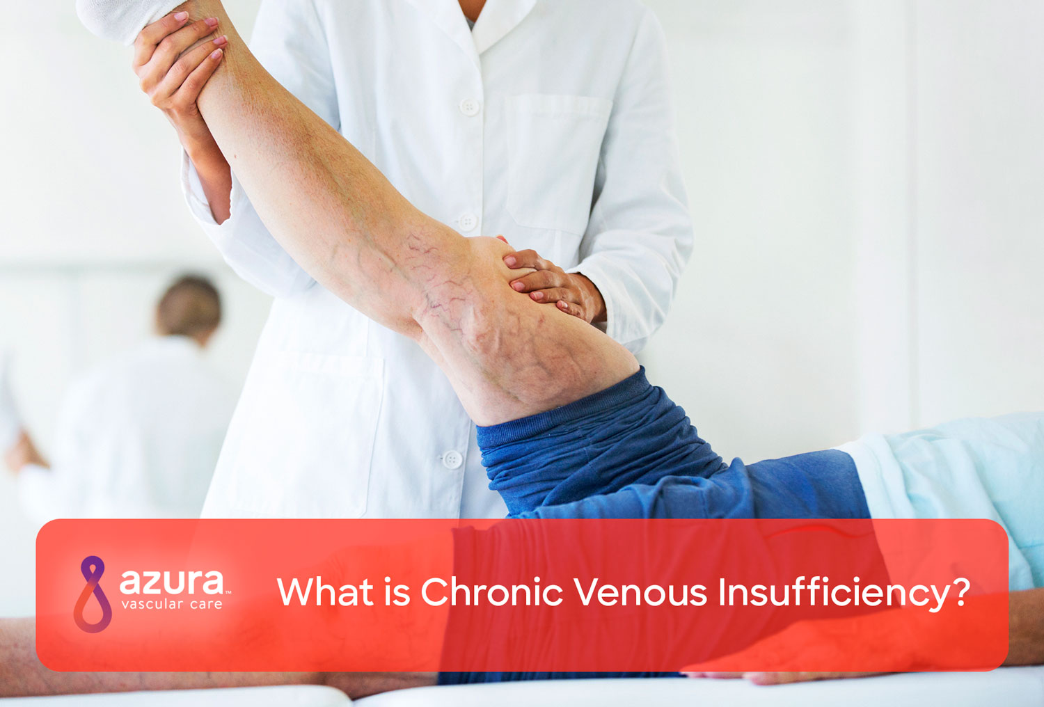 What Is Chronic Venous Insufficiency?