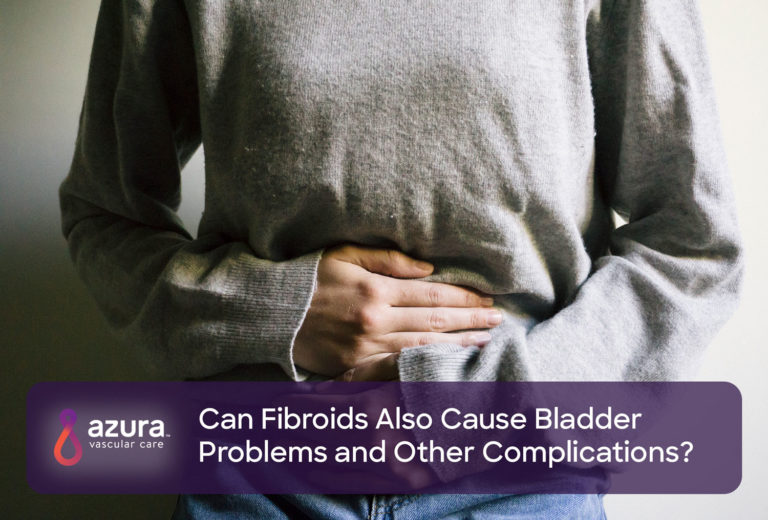 can-uterine-fibroids-cause-bladder-problems