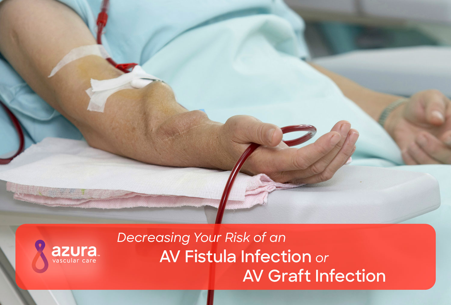 Decrease Risk Of Av Fistula Av Graft Infection