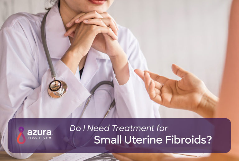 Treatment For Small Uterine Fibroids