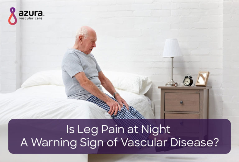 Leg Pain at Night. Is it a Warning Sign of Vascular Disease?