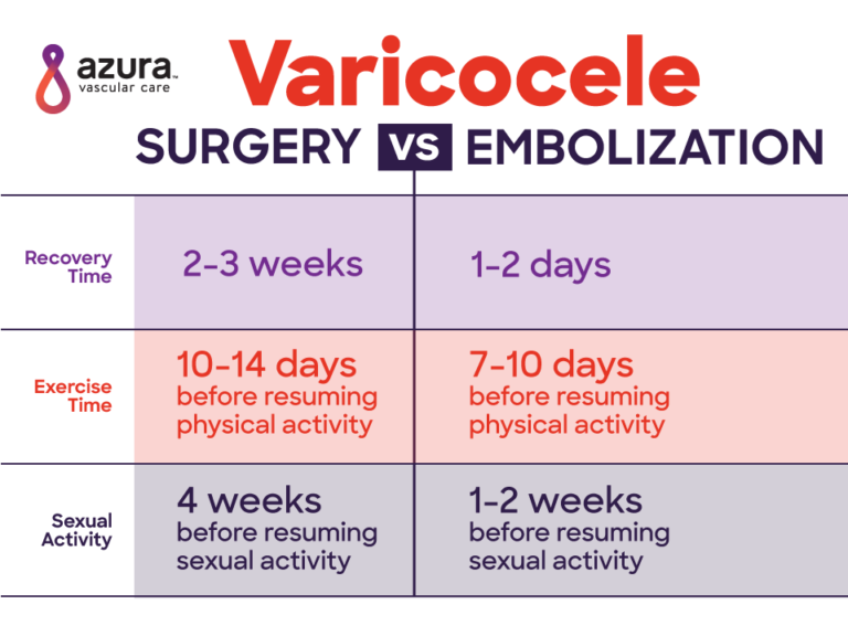 Varicocele Treatment Options Embolization Vs Varicocele Surgery