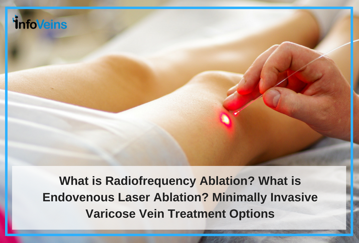 Understand Radiofrequency Ablation and Endovenous Laser Ablation