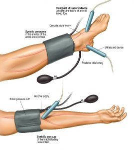 Tools Physicians Use for Diagnosing PAD | Azura Vascular Care