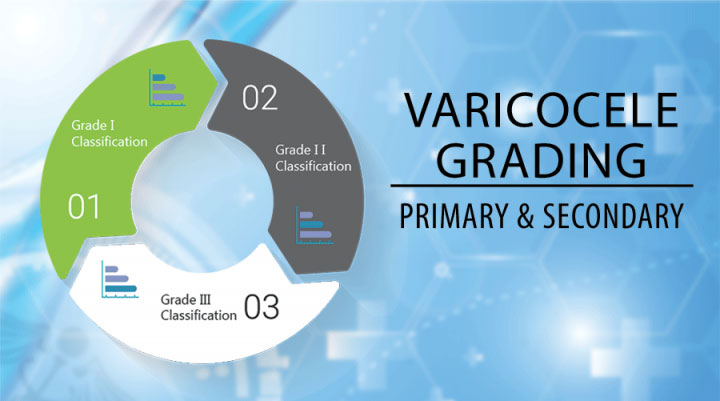 Varicocele Grading, Primary & Secondary