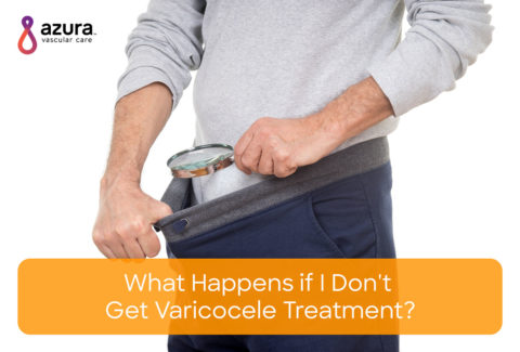 Treat Varicocele Infertility without Surgery